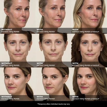 Base Instantanée FIRMx Sans Filtre