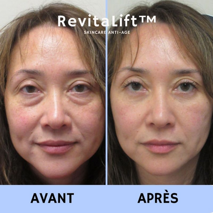RevitaLift™ Crème Liftante Anti-Rides Instantanée
