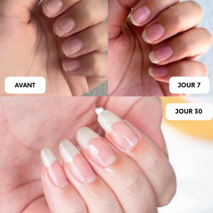 Sérum Revitalisant Almalys – Accélérateur de Pousse