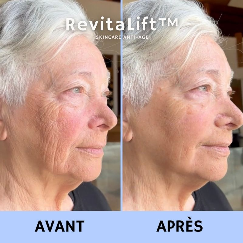 RevitaLift™ Crème Liftante Anti-Rides Instantanée
