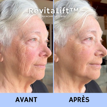 RevitaLift™ Crème Liftante Anti-Rides Instantanée