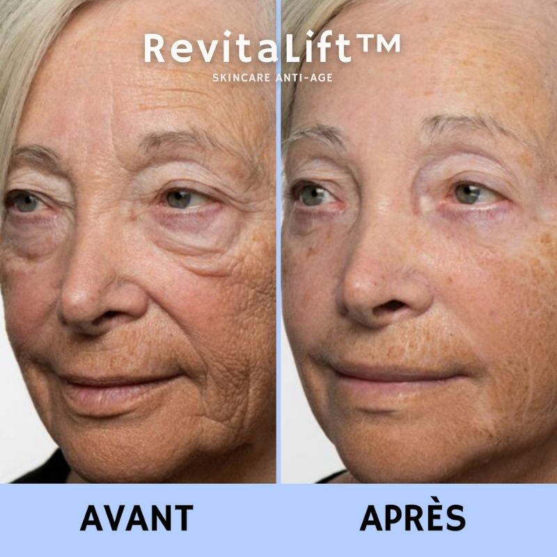 RevitaLift™ Crème Liftante Anti-Rides Instantanée