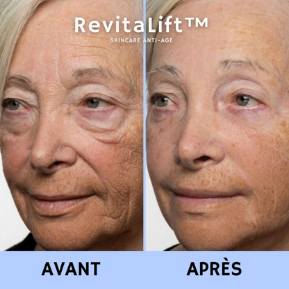 RevitaLift™ Crème Liftante Anti-Rides Instantanée