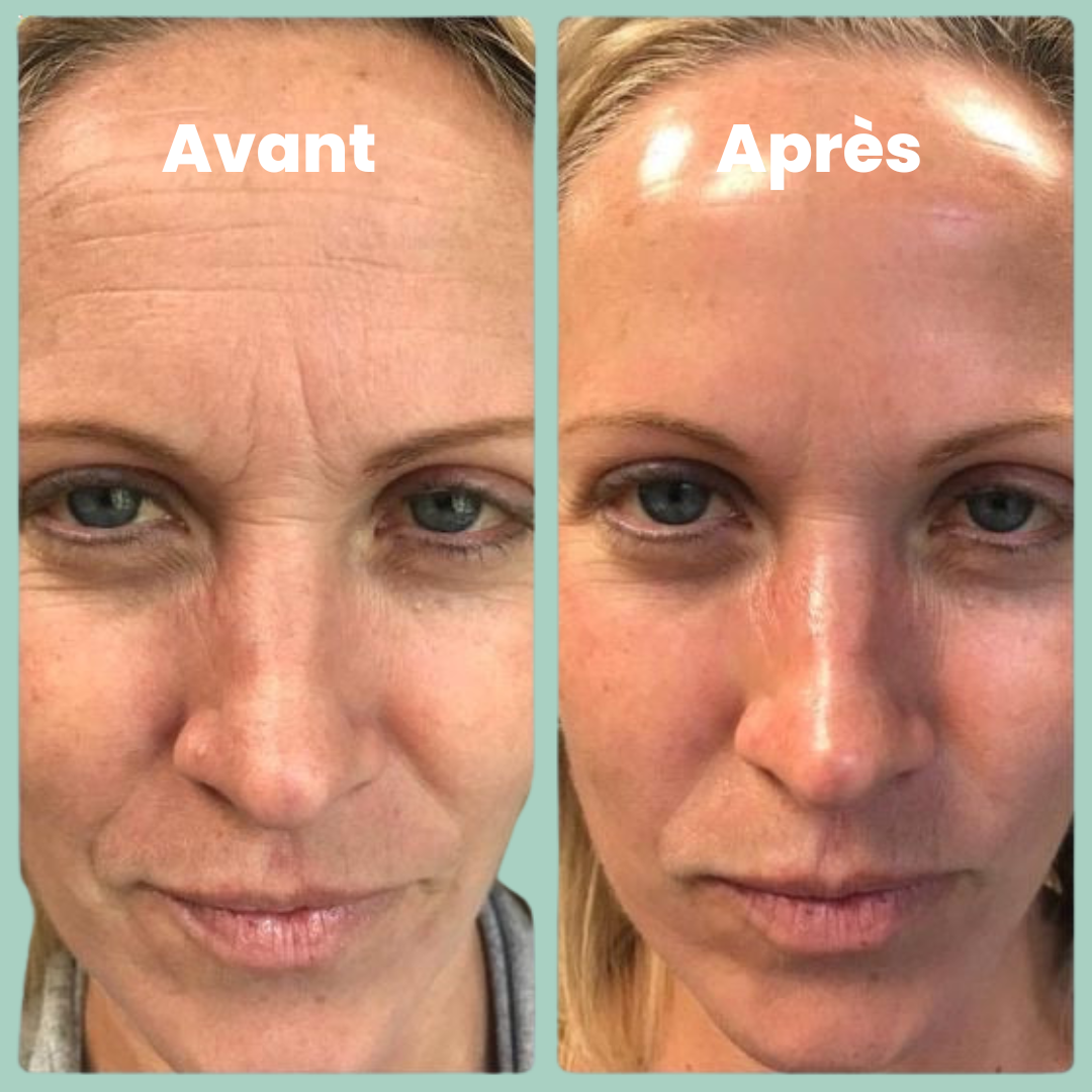 Masque au Bio-Collagene