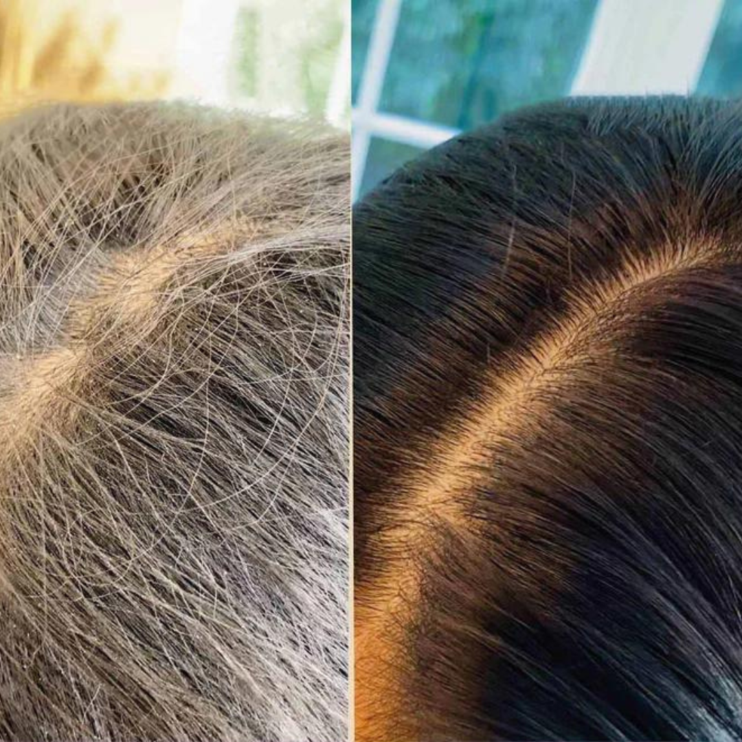 VitalColor™ - Shampoing Colorant Anti Cheveux Blancs