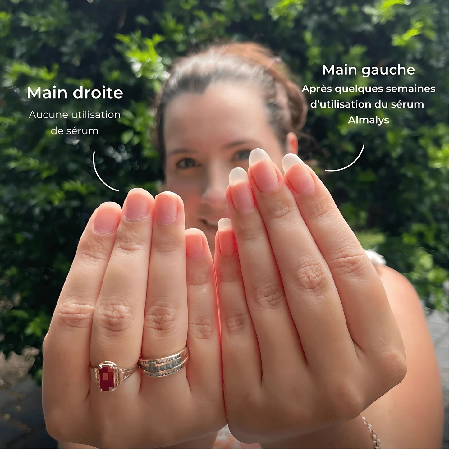 Sérum Revitalisant Almalys – Accélérateur de Pousse