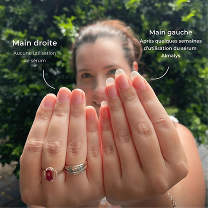 Sérum Revitalisant Almalys – Accélérateur de Pousse